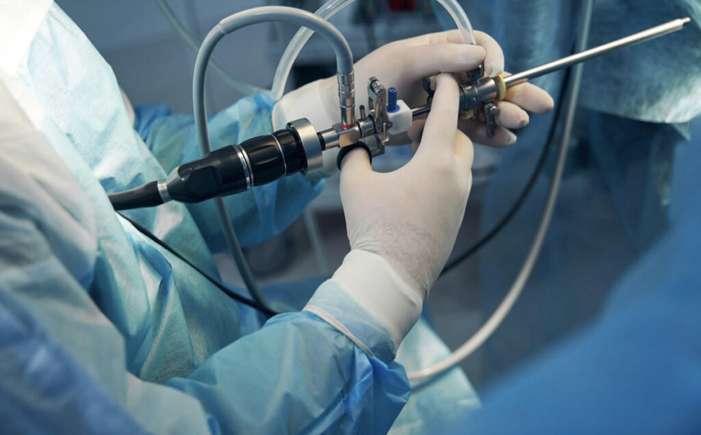 Laparoscopic Treatment in Gujarat